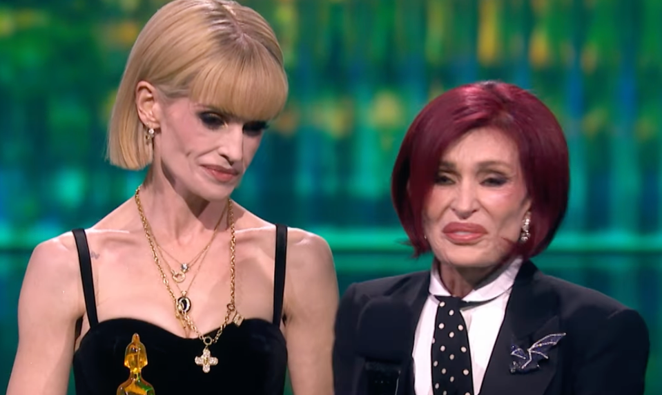 Vydesila fanúšikov! Tvár niekdajšej bacuľky je vychudnutá priam na lebku!