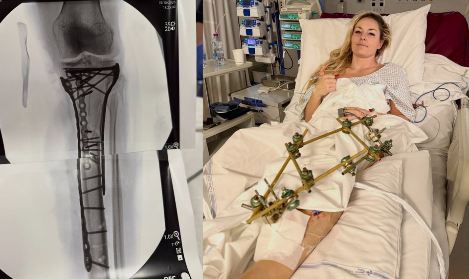 Hrozila mi amputácia, potvrdila Lindsey VONN