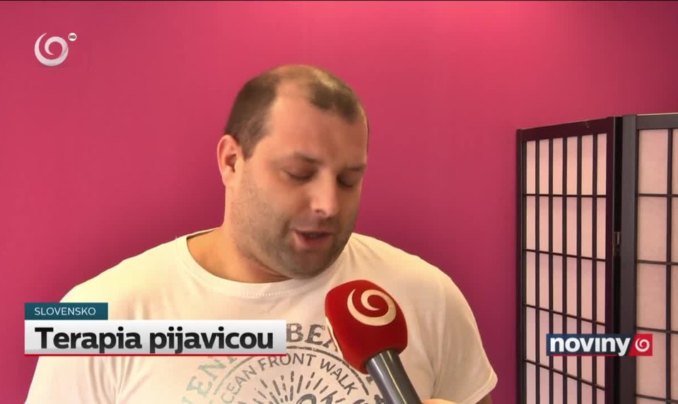 Terapia pijavicou