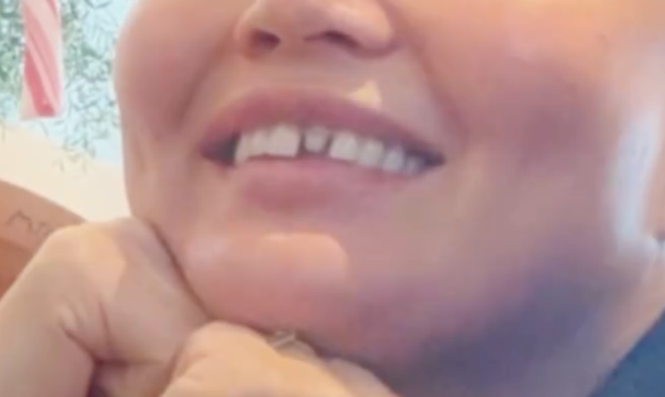 Vianočná chvíľka s deťmi nedopadla dobre! Hviezdna kráska prišla o zub!