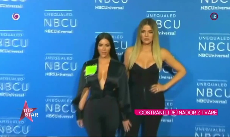 ODSTRÁNILI JEJ NÁDOR Z TVÁRE