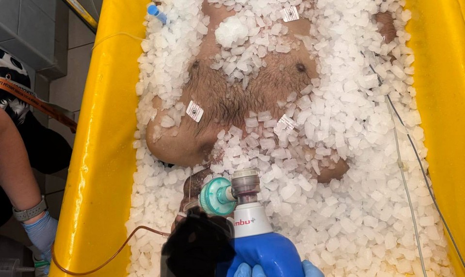 Horúčavy v Maďarsku: Prehriateho muža zachránili vďaka 30 kilám ľadu