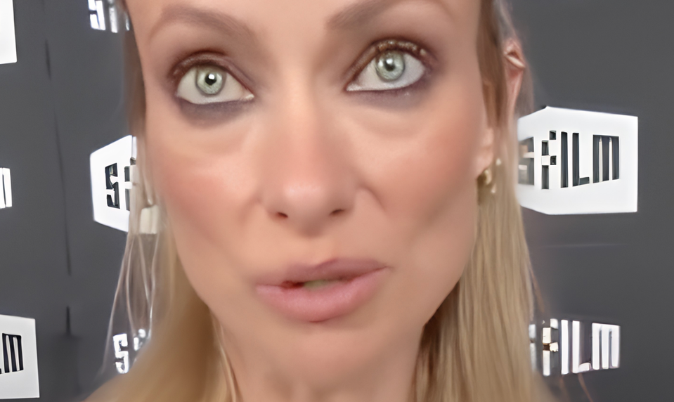 Obavy o zdravie známej herečky: Je za jej vychudnutou tvárou slávna „včelička“?