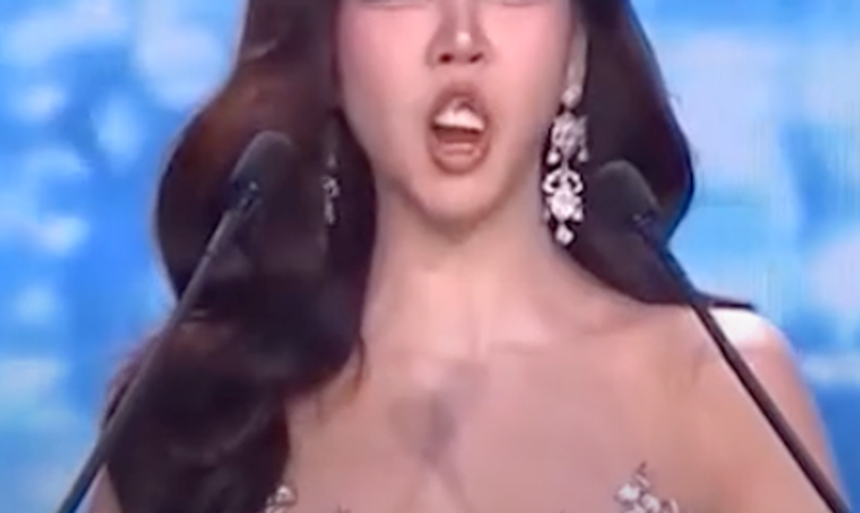 Príšerný trapas priamo na pódiu! Nádejnej Miss vypadla zubná protéza!