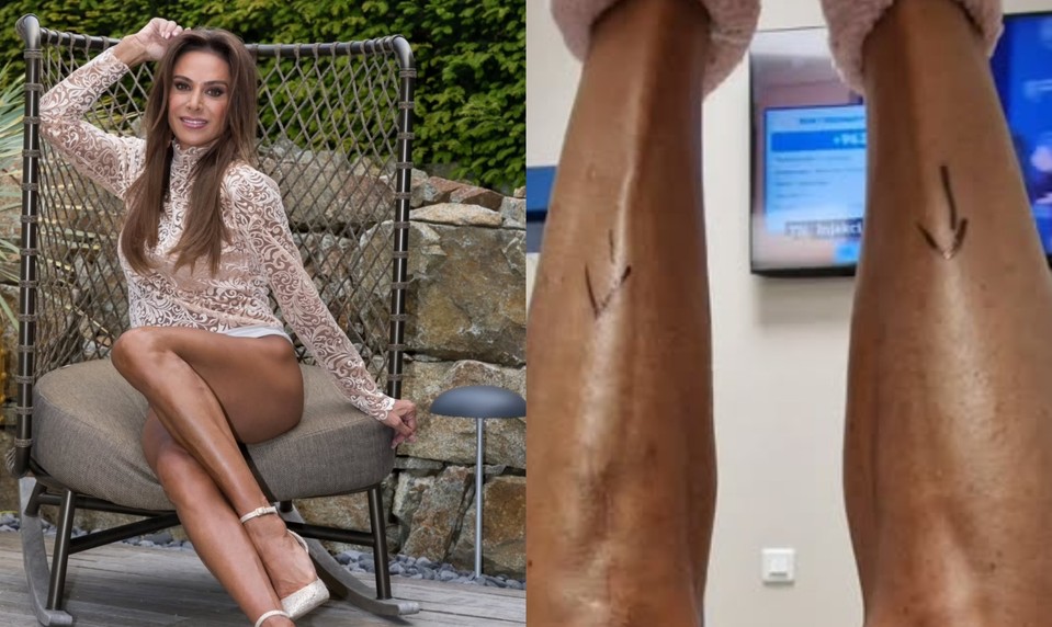 FOTO: Zora Czoborová ukázala, ako vyzerali jej NOHY pred operáciou: TOTO chcelo veľa odvahy!