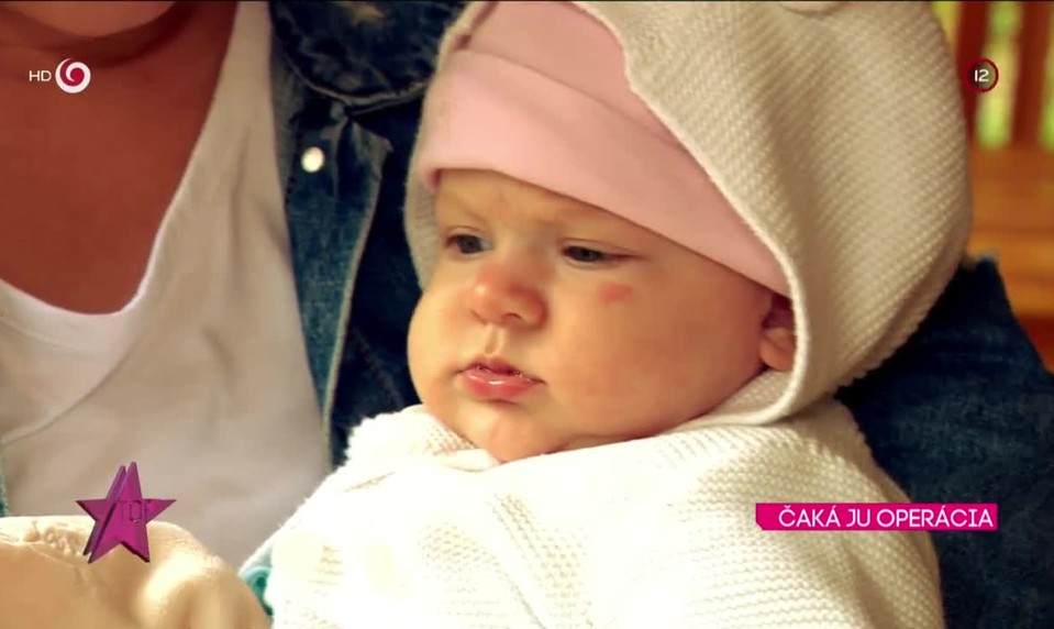 ČAKÁ JU OPERÁCIA