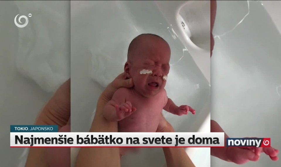 Najmenšie bábätko na svete je doma