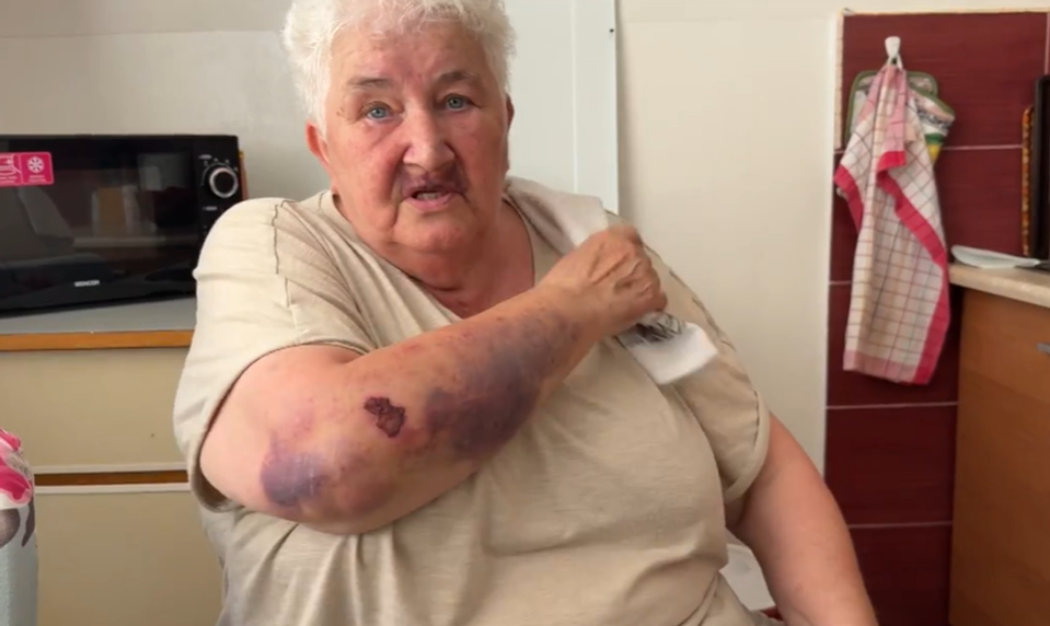 Dôchodkyňa bránila svojho invalidného syna pred útočníkmi. Obaja skončili so zraneniami