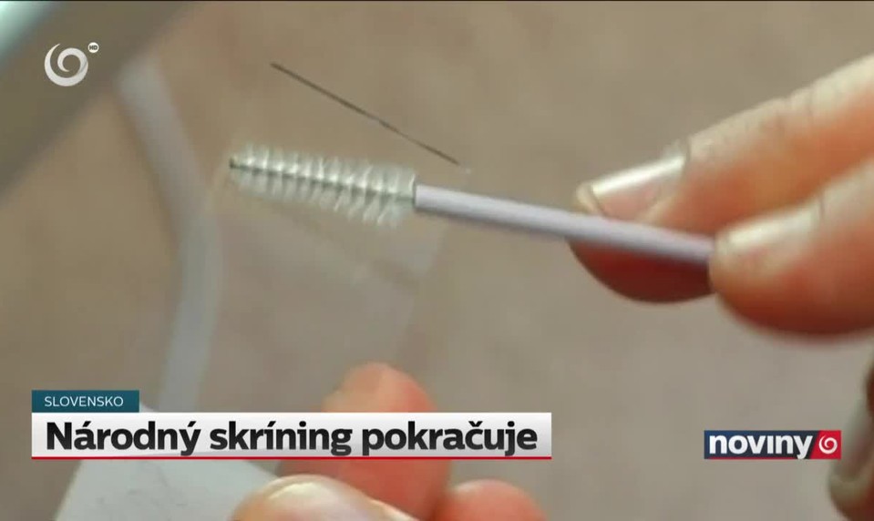 Národný skríning pokračuje