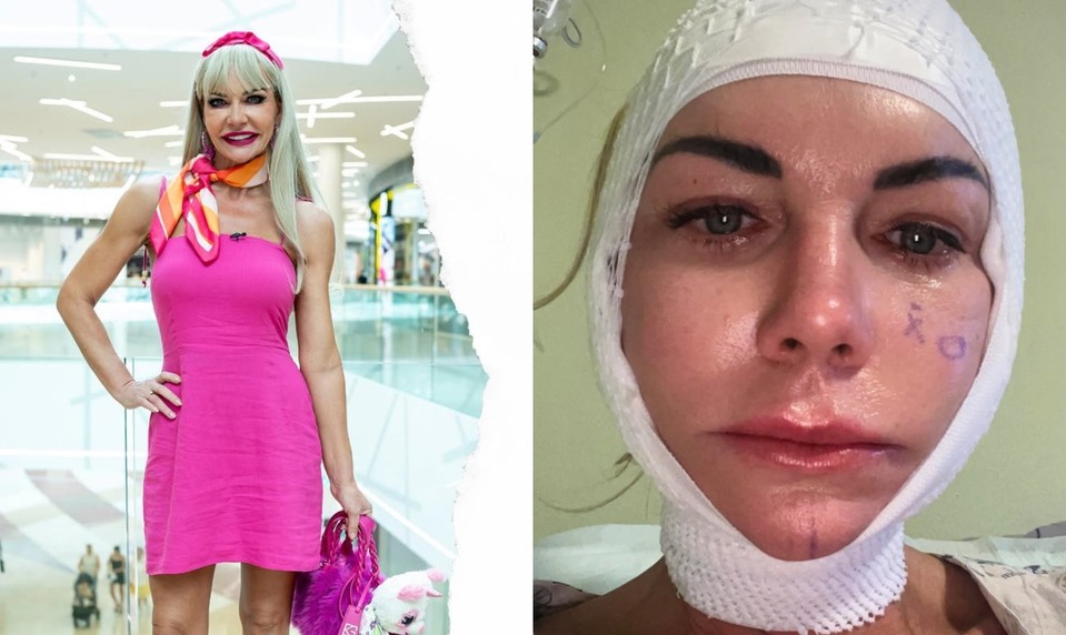 Dôverovala lekárke, zaplatila TVÁROU: Šokujúca spoveď Moniky Nemčokovej z Maniačok!