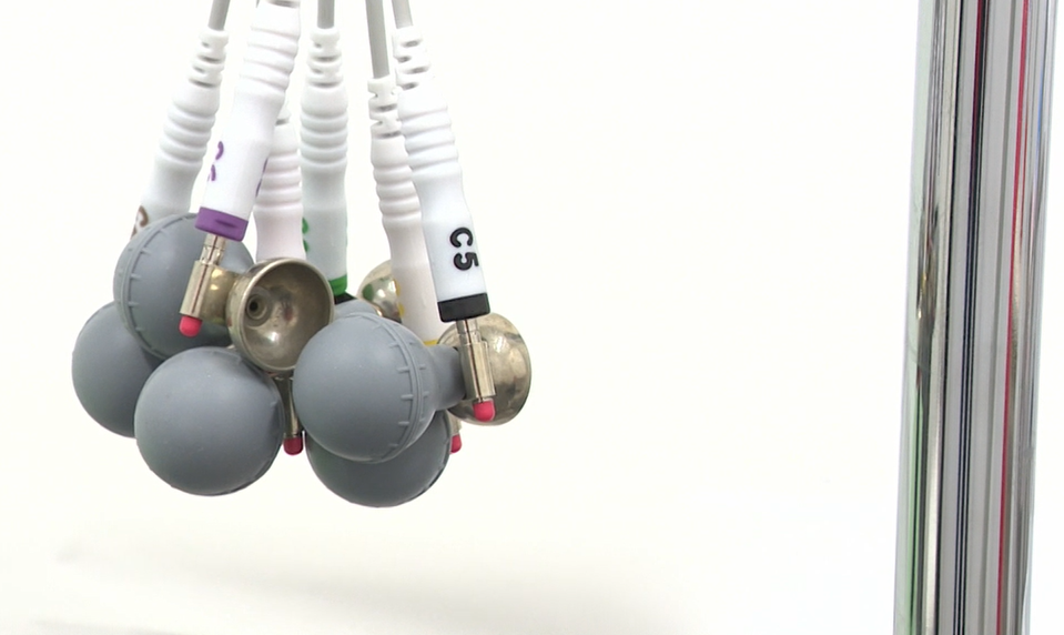 Má schválený liek, no dopláca 1700 eur mesačne. Raritní pacienti čakajú na spravodlivejší zákon