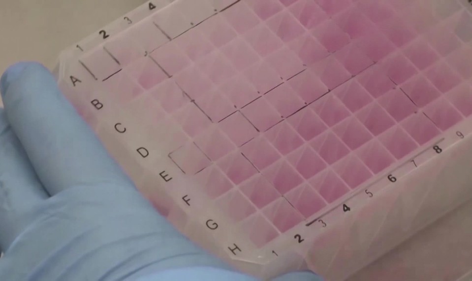 Na Slovensku potvrdili prípad opičích kiahní. Pacienta hospitalizovali na infekčnom oddelení