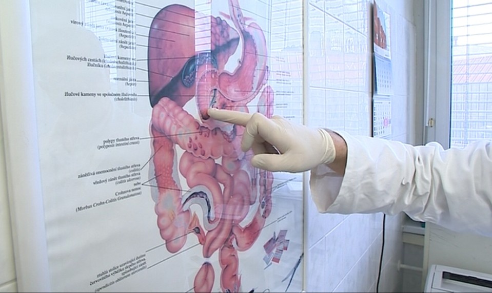 Až 40 percent Slovákov trpí touto nákazou: Máte aj vy infekciu, ktorá ničí trávenie?