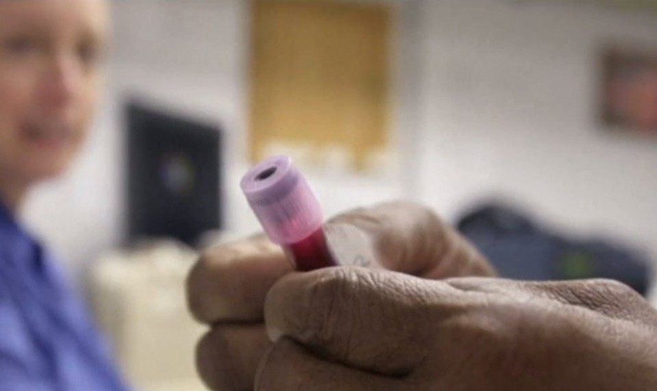 Tieto 3 faktory spôsobujú až polovicu úmrtí na rakovinu: Odstrániť ich môže každý!