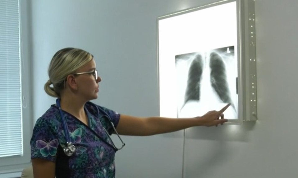 Nedostatok pľúcnych lekárov: Nové ambulancie sa finančne neoplatia, čo bude s pacientmi?