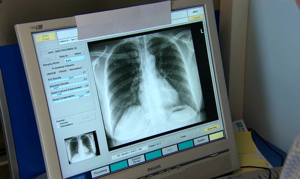 13 ochorení, ktoré ohrozujú vaše pľúca: Čo robiť, ak sa vám ťažko dýcha?