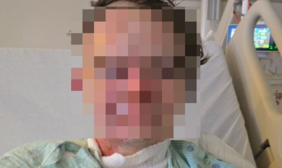 Mladík utrpel vážne popáleniny po útoku kolegu. Vylial naňho žeravý olej