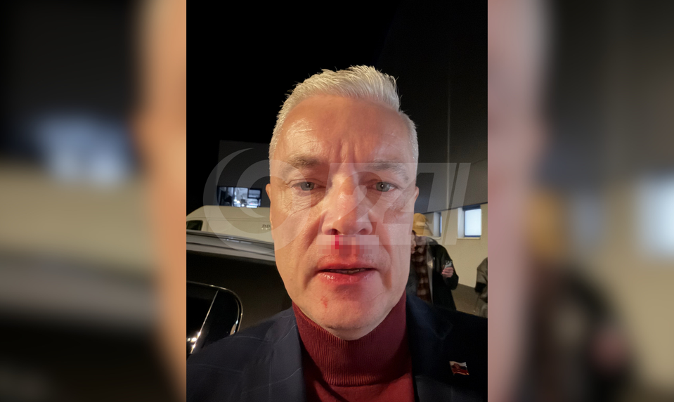 Ferenčák: Fyzicky ma napadli pred dcérou, skončil som na zemi, tiekla mi krv