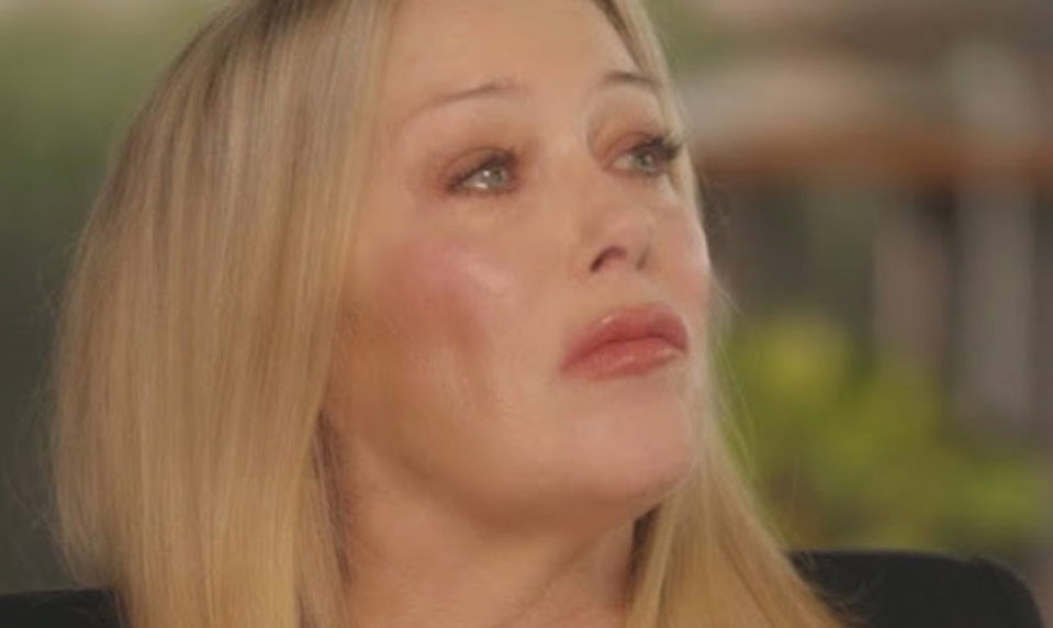 Trpké slová nevyliečiteľne chorej herečky: Vždy keď sa vidím na fotkách, chce sa mi zvracať!