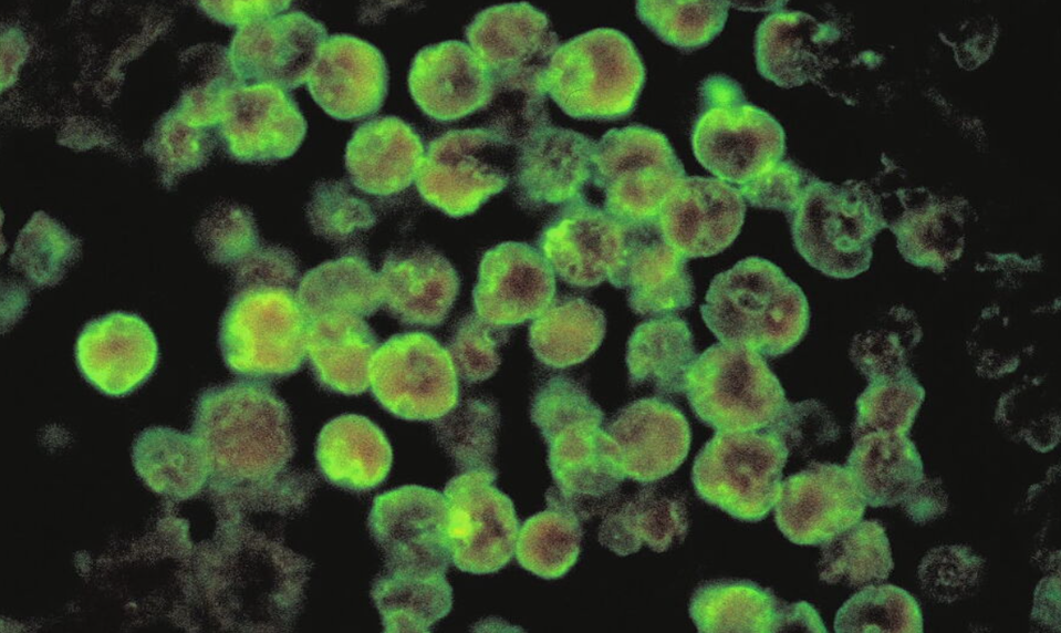 Vo vzorkách z kúpaliska Vadaš hygienici nepotvrdili prítomnosť améby Naegleria fowleri