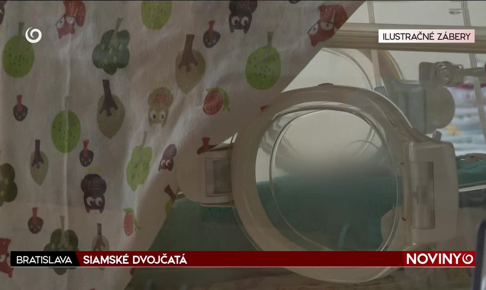SIAMSKÉ DVOJČATÁ