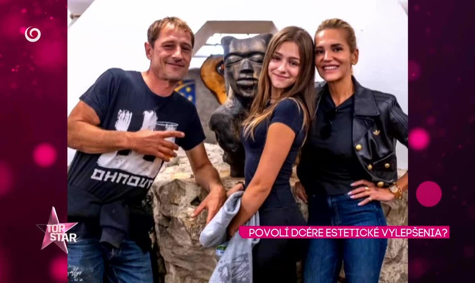 POVOLÍ DCÉRE ESTETICKÉ VYLEPŠENIA?