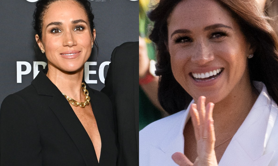 Nové fotky Meghan Markle vyvolali rozruch. Plastický chirurg v tom má jasno!