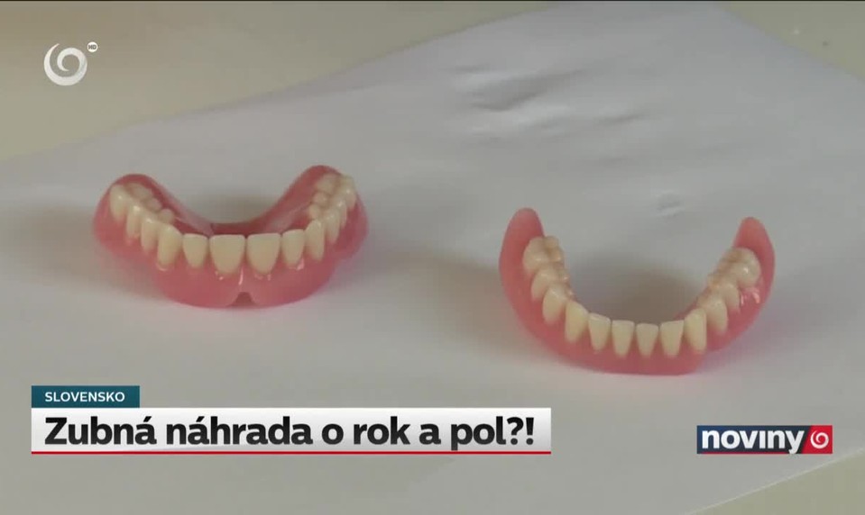 Zubná náhrada o rok a pol?!