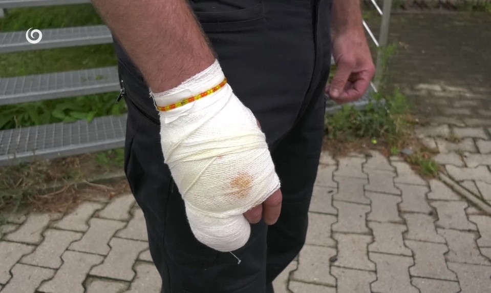 Medveď zaútočil na muža v Závažnej Porube: Spôsobil mu ľahké zranenia