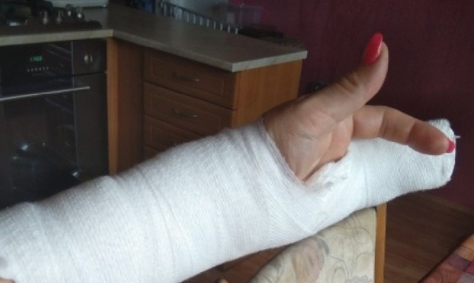 Každá bolesť ruky nie je syndróm karpálneho tunela! Takto ju odlíšite