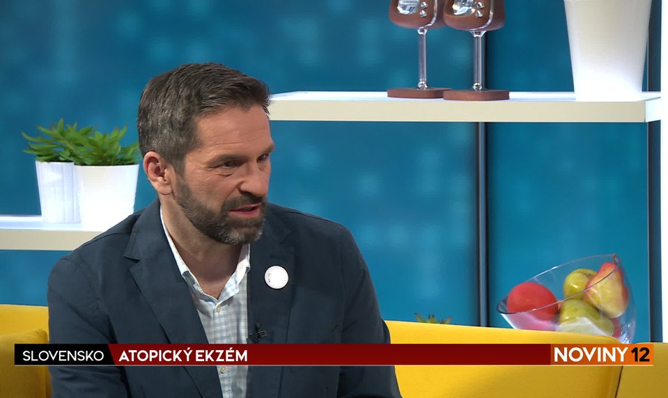 Atopický ekzém