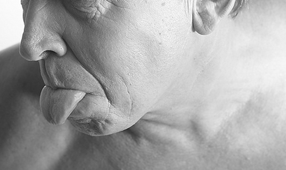 Lekár o nádoroch hlavy a krku: Naši pacienti chodia neskoro, TIETO príznaky si  všímajte!