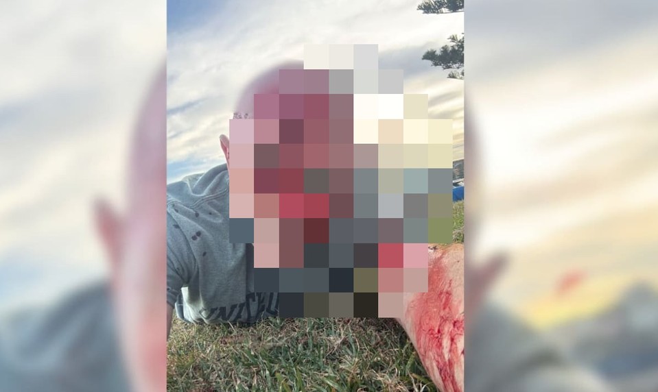 Prežil útok Hamasu, teraz zažil kviprelievanie na pláži v Austrálii. Právnik opísal chvíle hrôzy