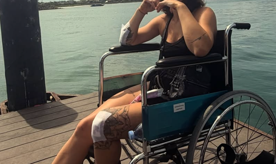 Hrozivé zábery z nehody slovenskej influencerky na Bali: TOTO jej zachránilo život!