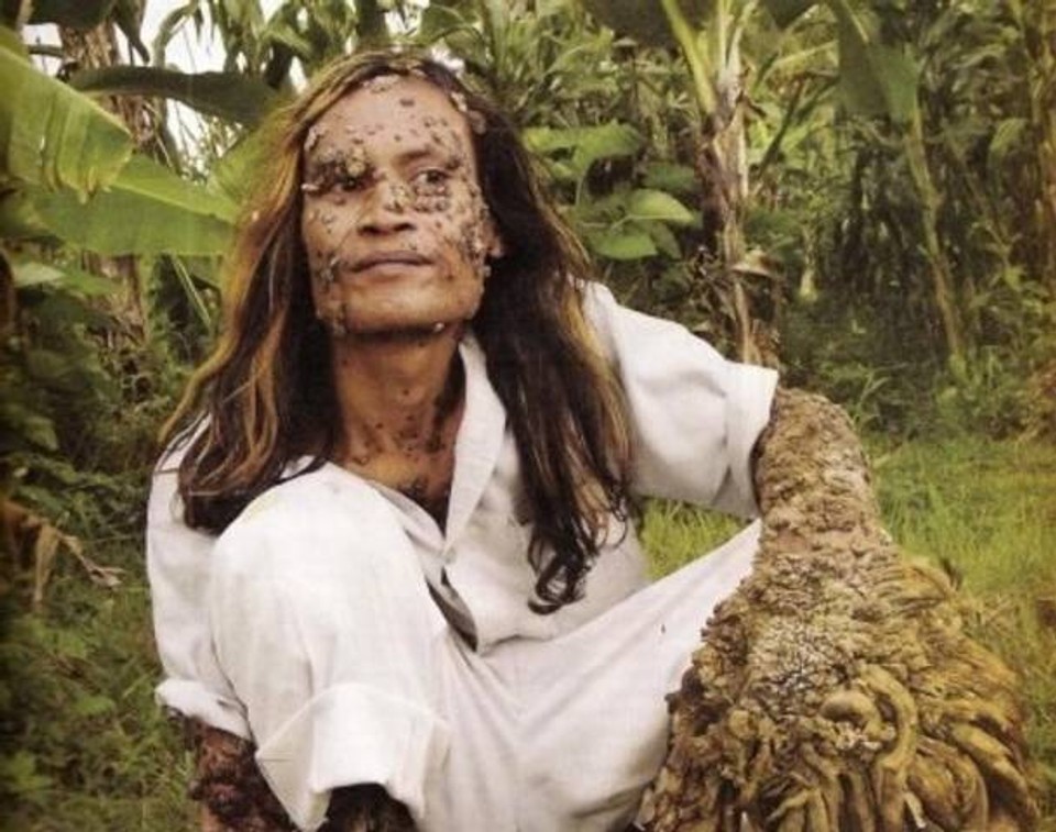 Trochu inak narodení 11