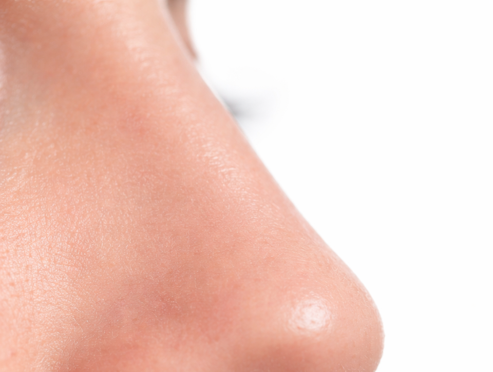 8 dôvodov, prečo máte upchatú jednu nosovú dierku: Kedy to treba riešiť?