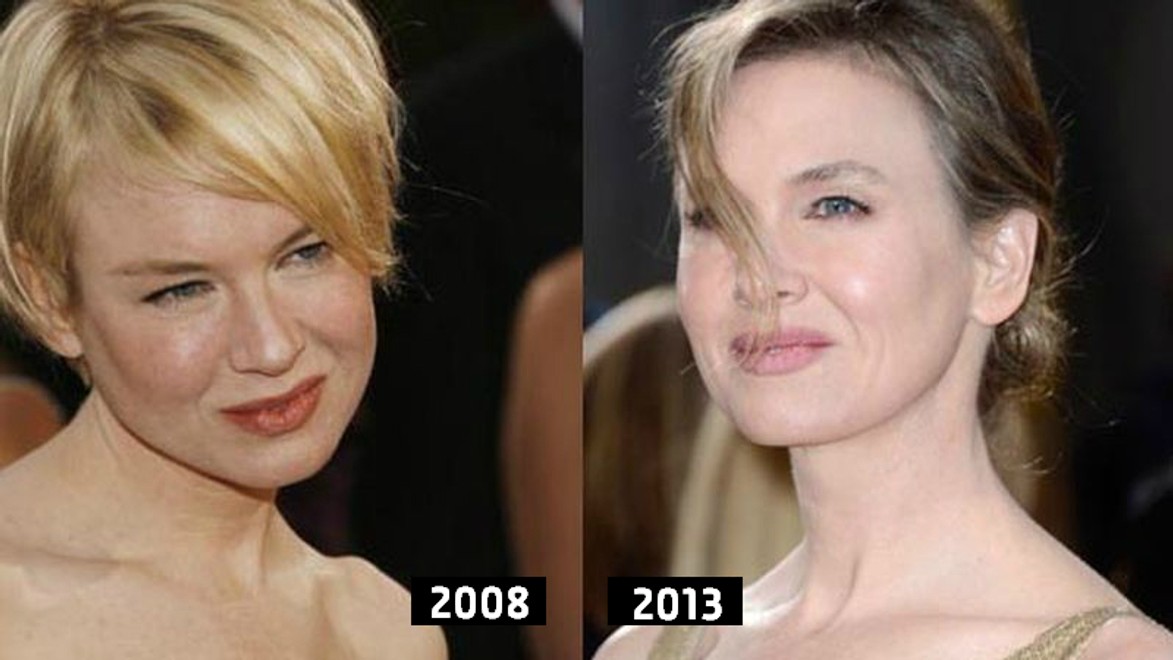 Renée Zellweger a plastika? Ona mlčí, fotky hovoria za ňu