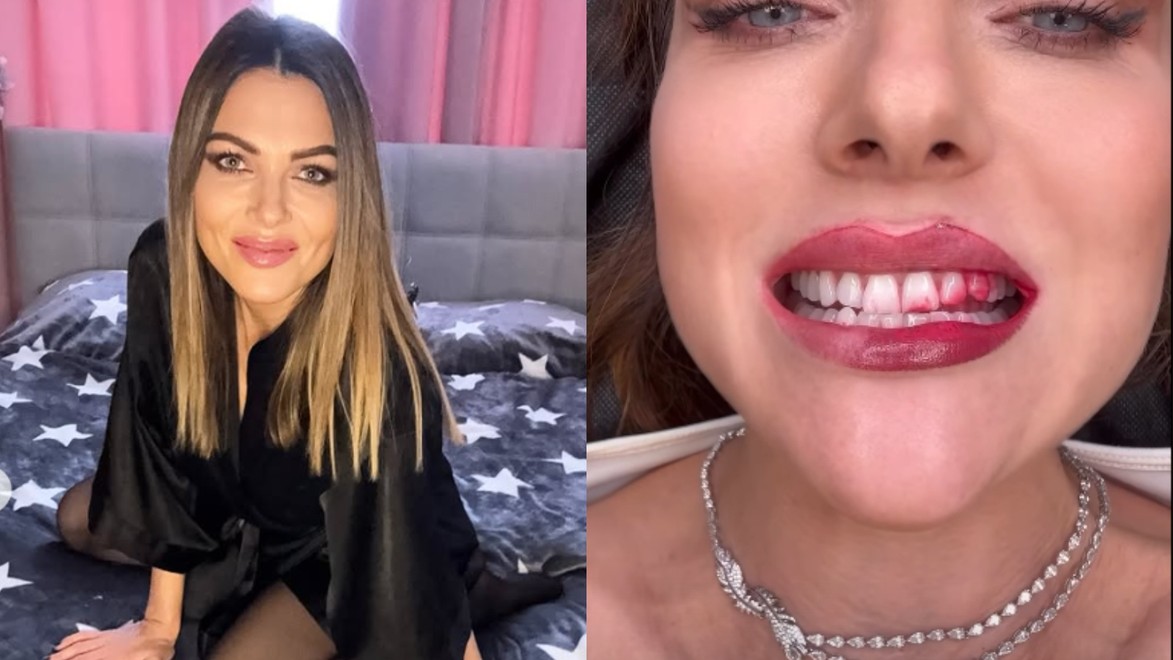 Martina Schindlerová šokovala KRVAVÝM úsmevom: Fanúšikovia sa zľakli, čo sa jej stalo!